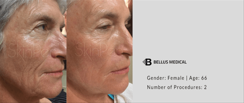 Chesterton, IN Plastic Surgeon | Chesterton, IN Plastic Surgeon | Glazer  Facial Plastic & Cosmetic Surgery