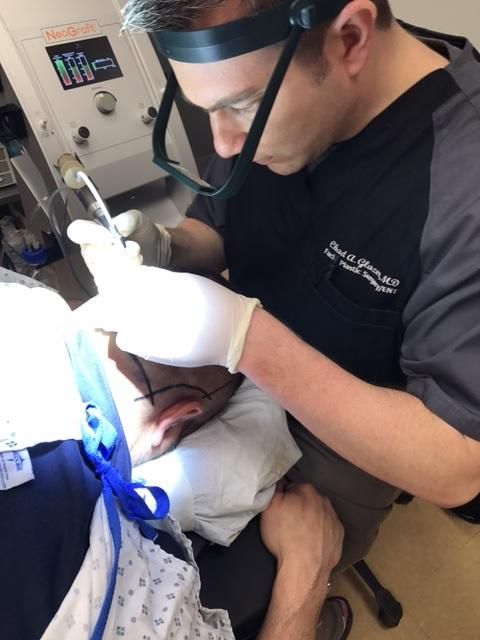 A recent neograft hair restoration procedure job in the Chesterton, IN area