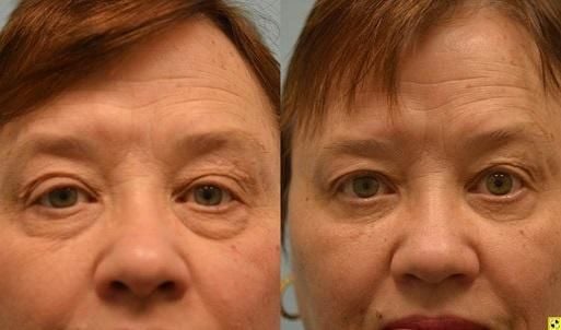 A happy customer of Glazer Facial Plastic & Cosmetic Surgery