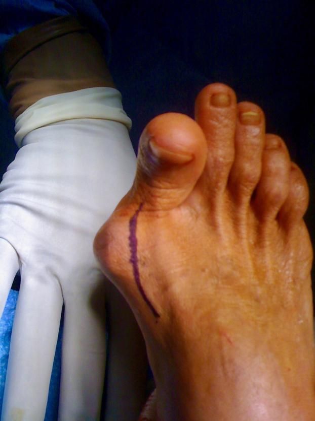 Before a completed podiatrist project in the  area