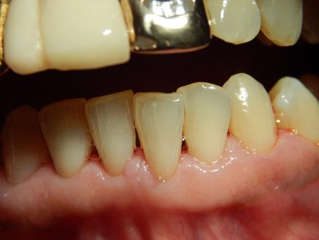 After a completed dentist project in the  area